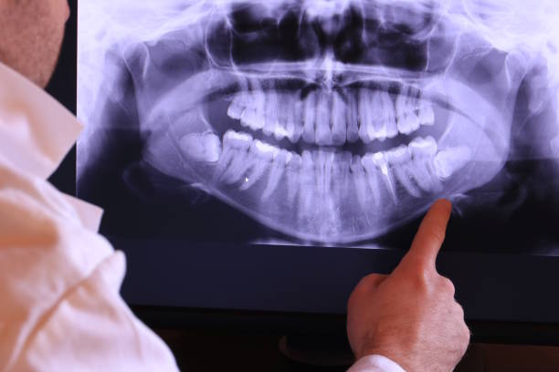 Best Emergency Treatment for Oral Infections in Parks, AZ