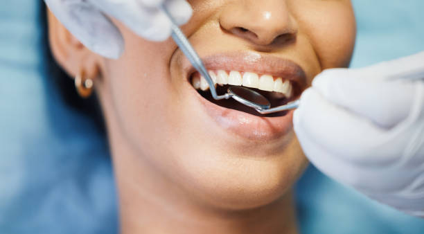 Best Emergency Dental Care for Sports Injuries in Parks, AZ