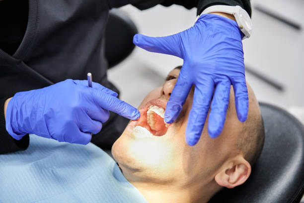 Best Emergency Wisdom Tooth Extraction in Parks, AZ